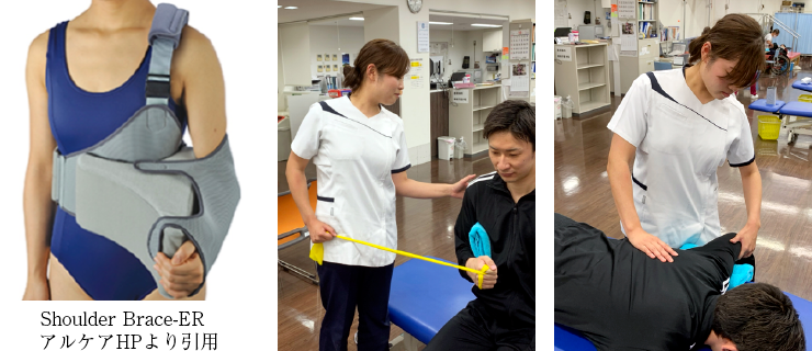 肩関節の術後の理学療法